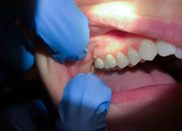 Best After-Hours Dental Trauma Care in Keedysville, MD